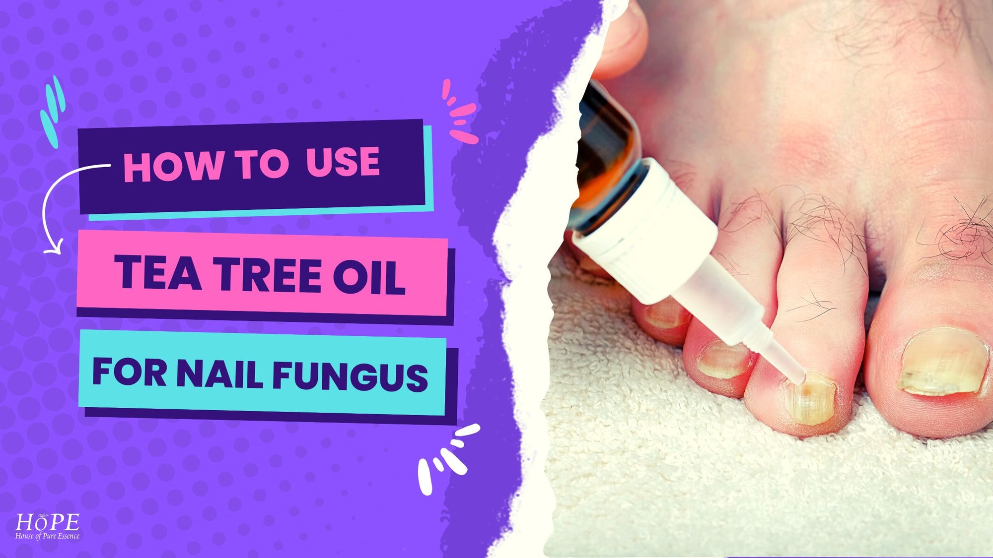 How to Use Tea Tree Oil for Nail Fungus?